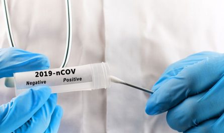 Как сдать на антитела к коронавирусу в Москве бесплатно?